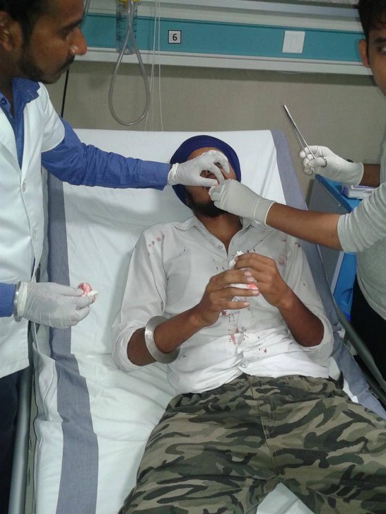 Another Sikh injured in Tarn Taran police firing
