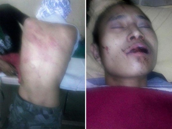 Two Naga boys beaten up in Gurgaon