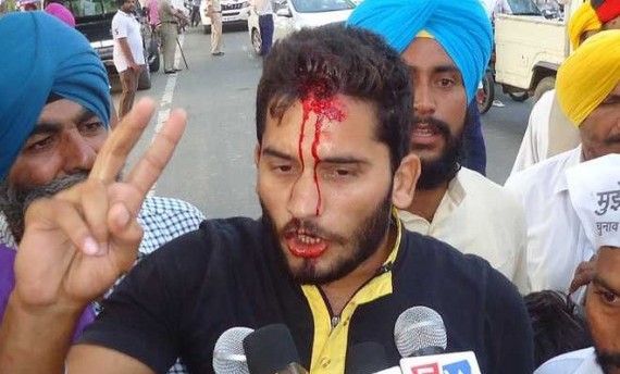 An injured AAP worker talks to mediapersons at a rally in Tarn Taran on Wednesday
